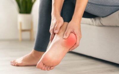Plantar Fasciitis Treatment in Eltham
